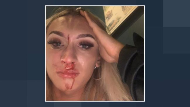 Transgender woman Anna Montgomery was left bloodied and bruised after being attacked and punched repeatedly in the face in a restaurant in Belfast in what police are investigating as a hate crime.