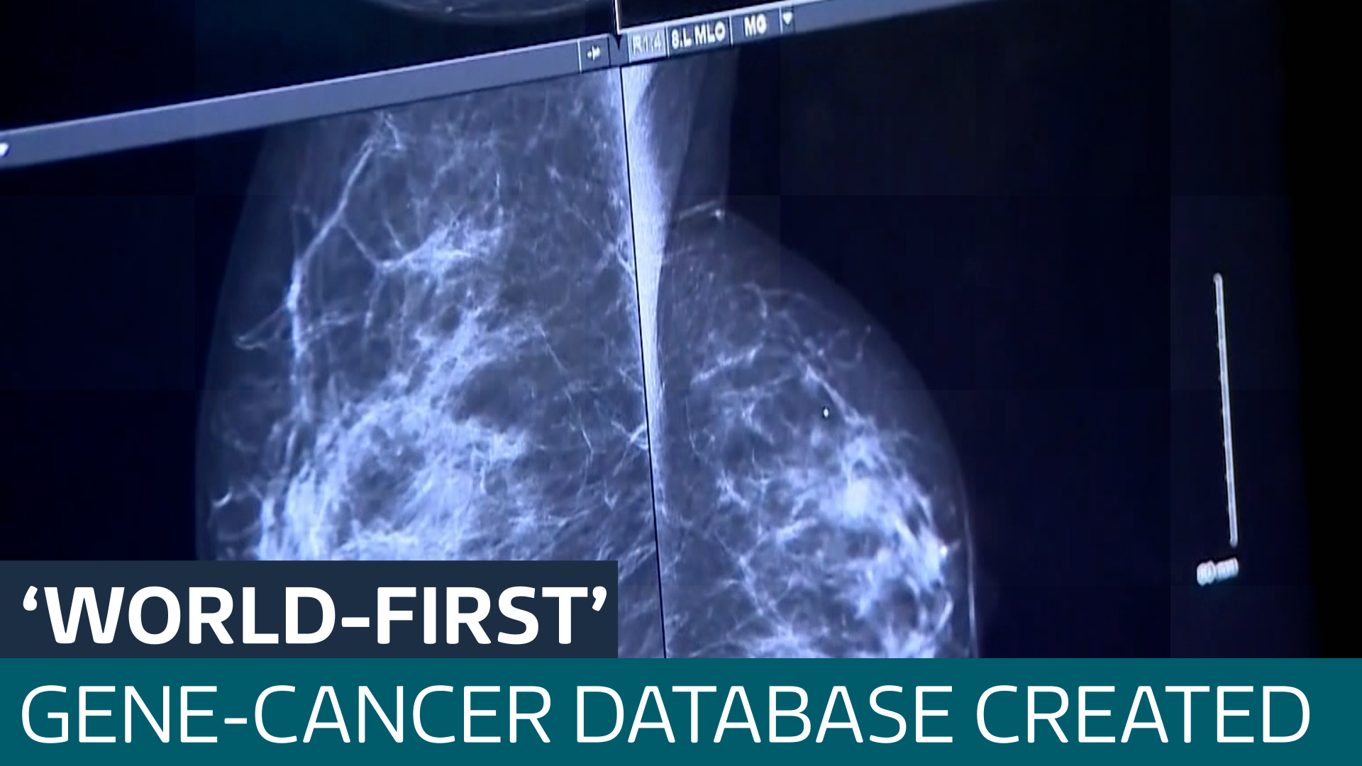 NHS England to develop ‘world-first’ database for genes linked to cancer - Latest From ITV News