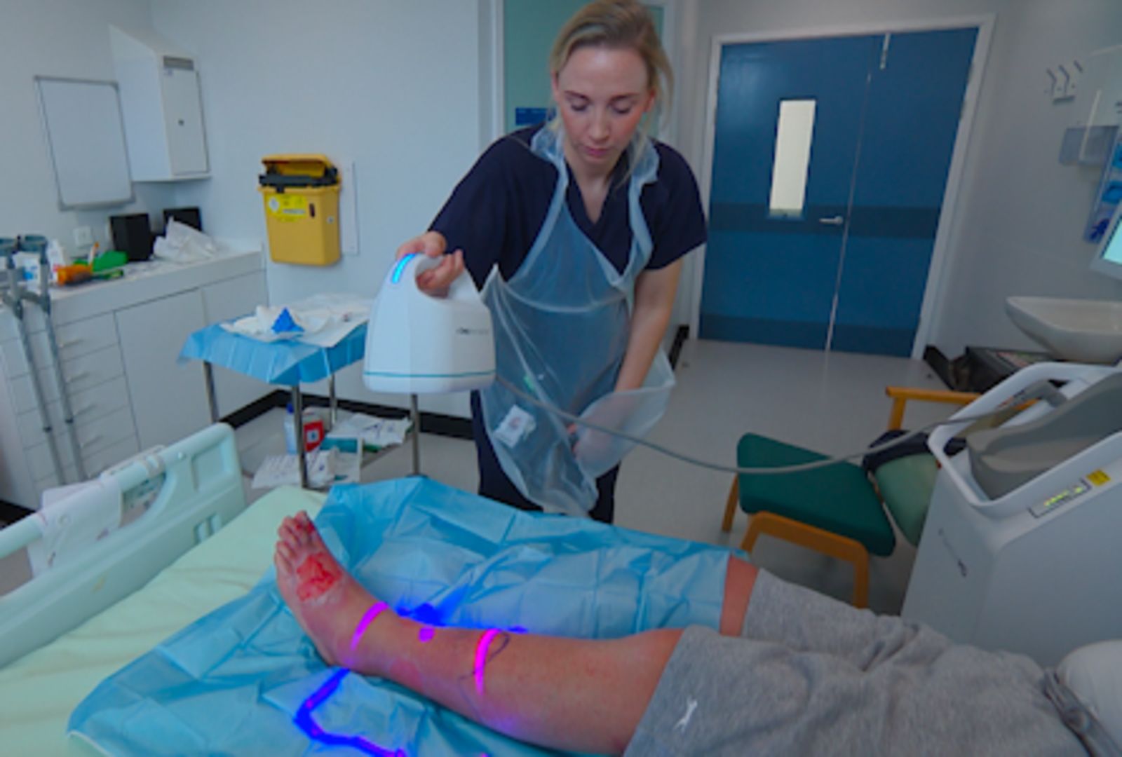 World first as Newcastle's Royal Victoria Infirmary burn centre trials ...