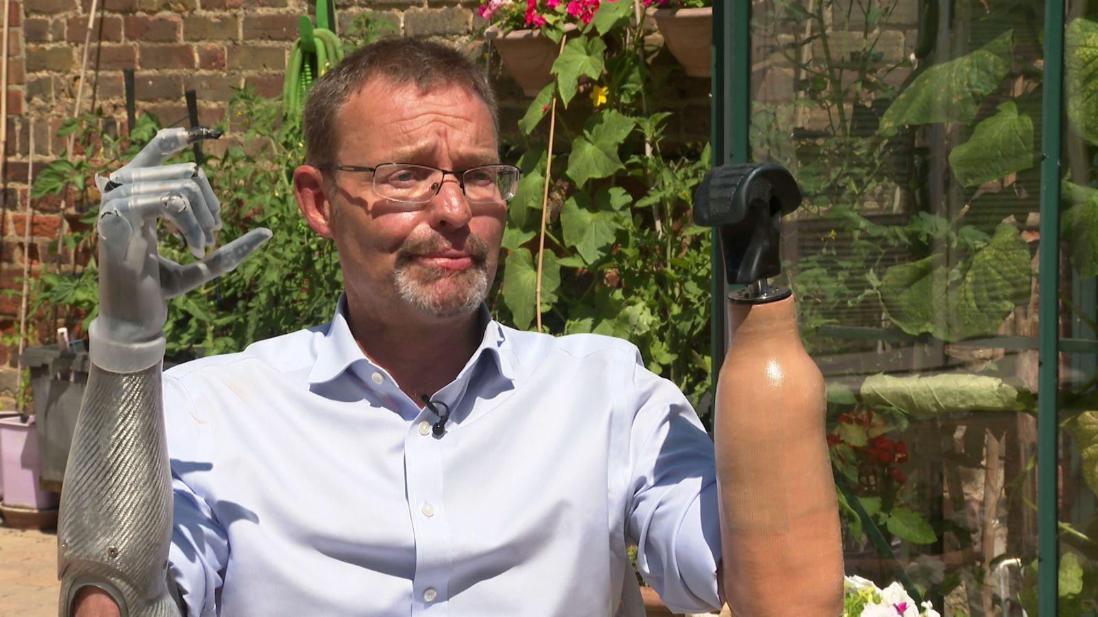 Bionic Mp Kent's former bionic MP Craig Mackinlay calls for better NHS ...