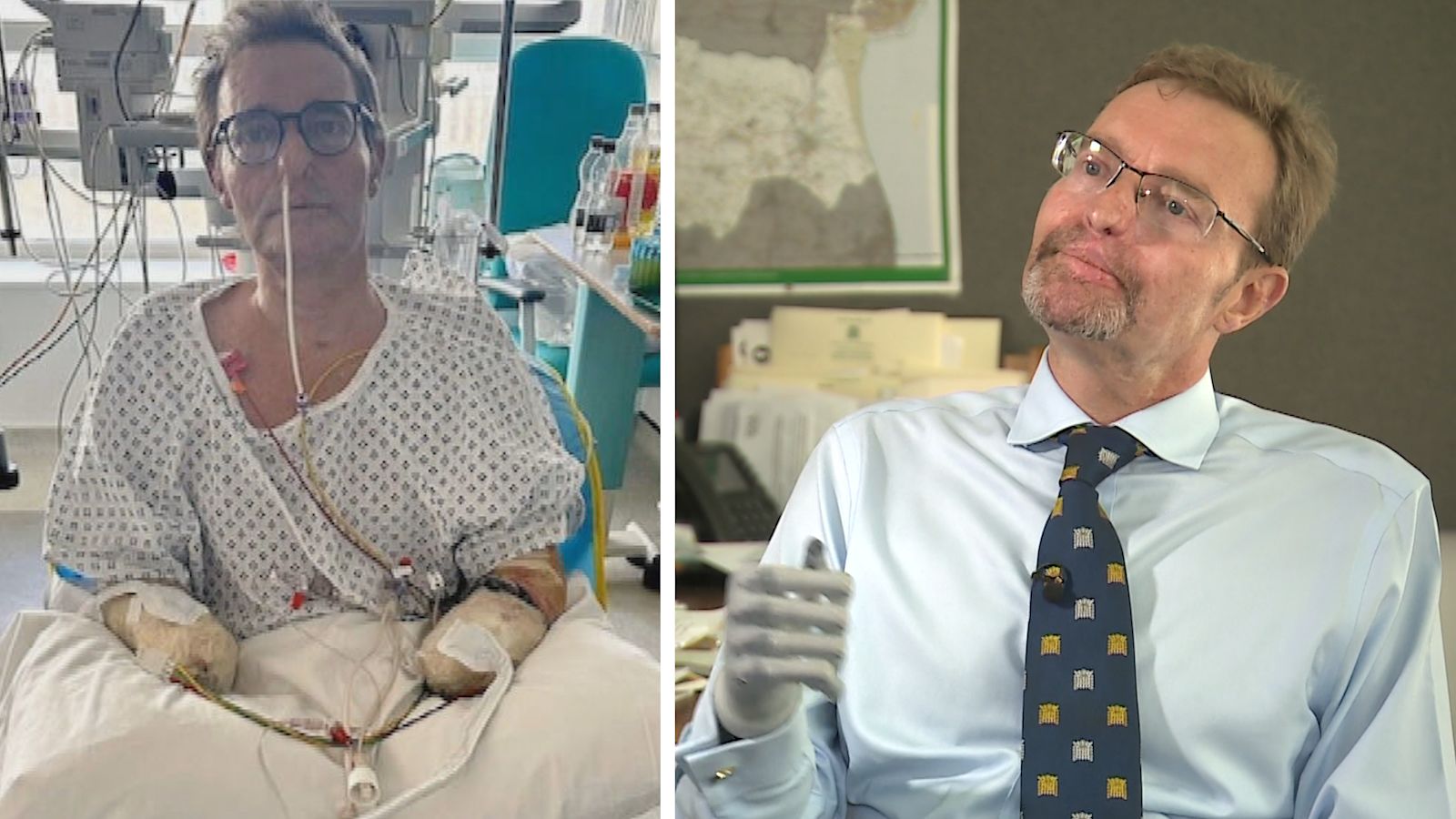 Bionic Mp 'Bionic' MP Craig Mackinlay was two hours away from death in sepsis ...