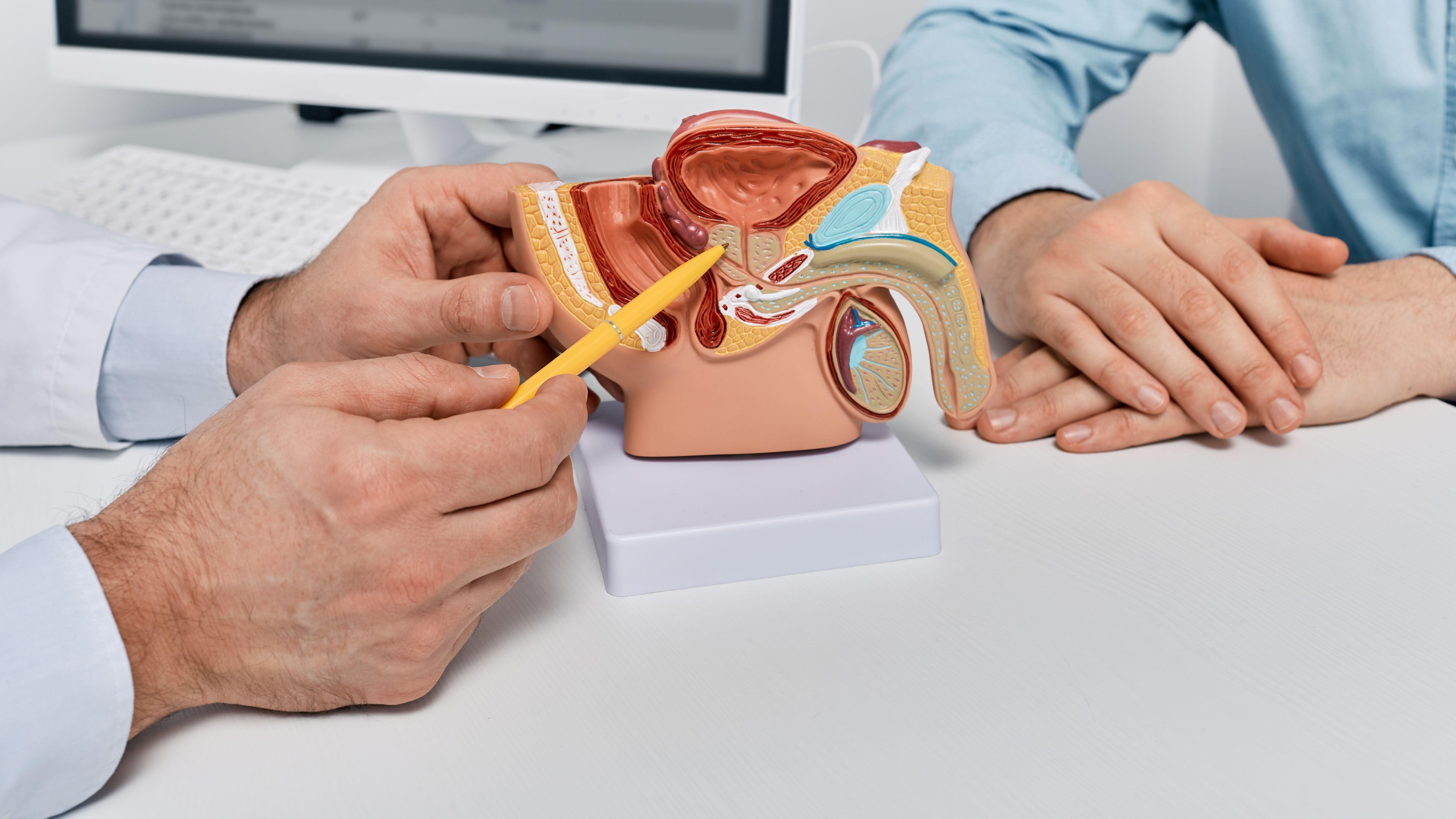 A doctor consulting a male patient using a pen to point at a reproductive system model