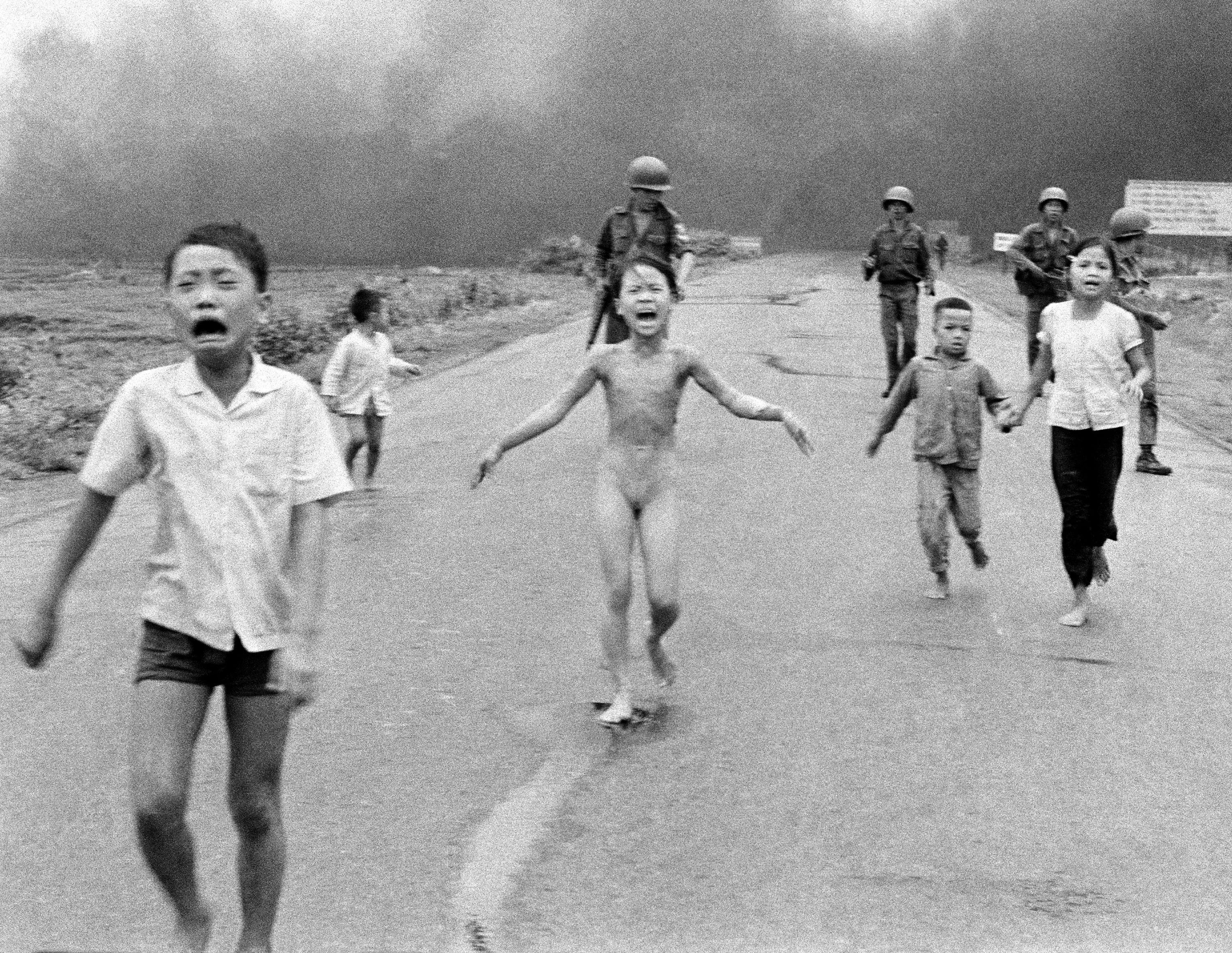 Vietnam Napalm Girl receives final skin treatment 50 years after