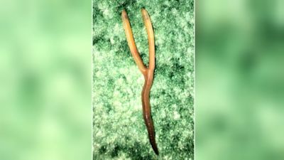two headed worm credit Gloucestershire Live