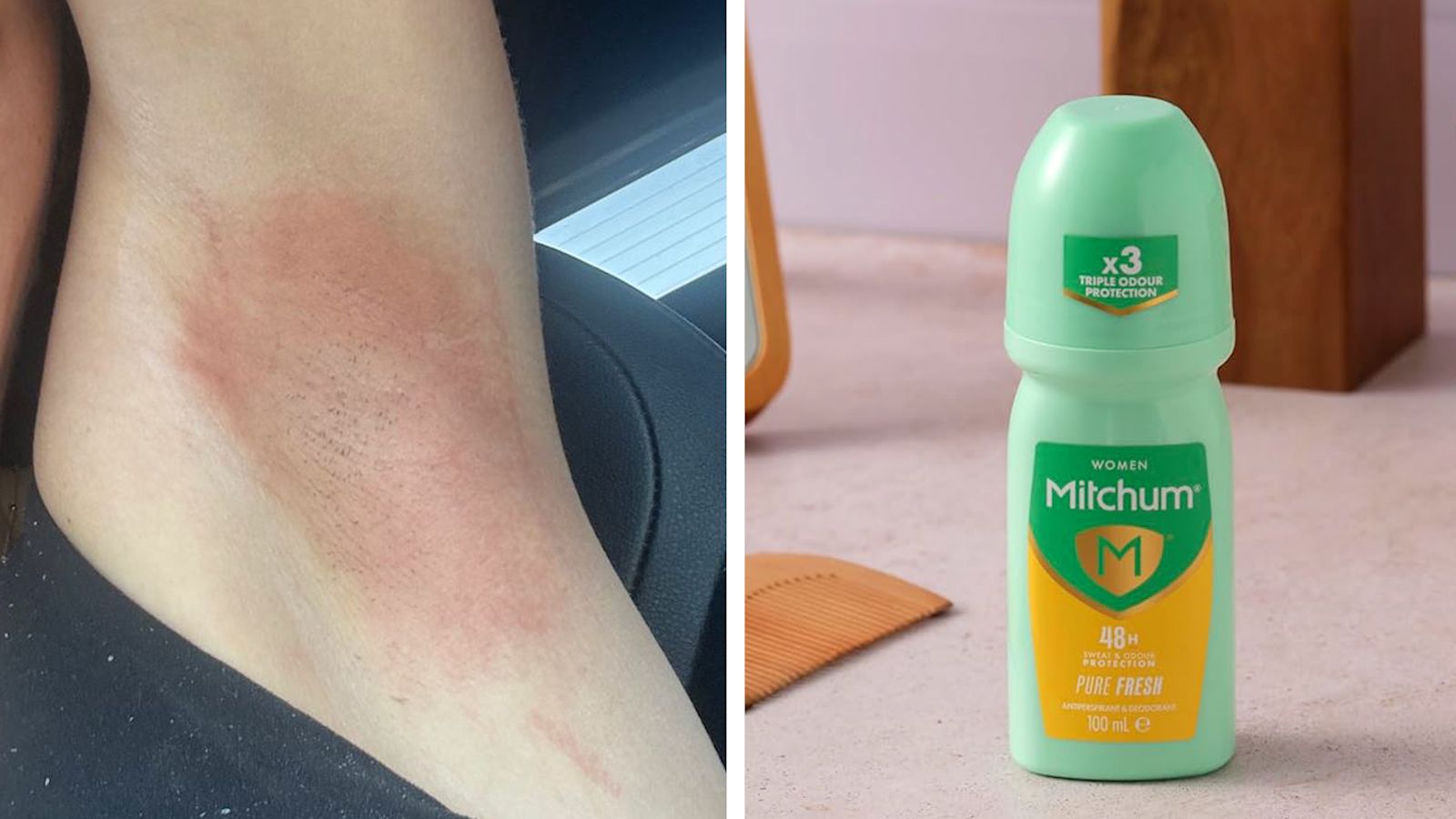 Deodrant Rash Mitchum apologises after deodorant leaves customers with 'burning ...