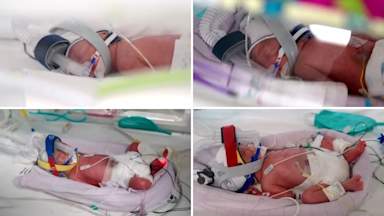 Australian woman gives birth to rare identical quadruplets