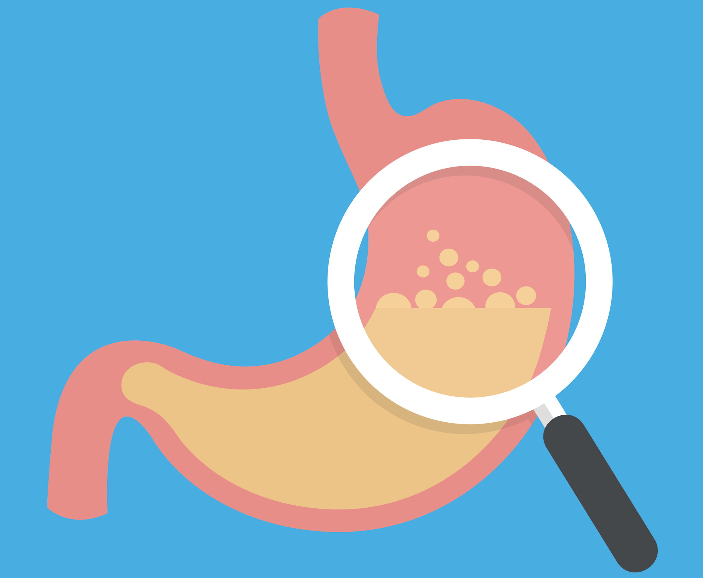 Was hilft gegen Gastritis? - CARA CARE