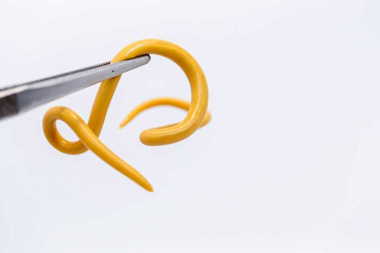 Tapeworm Symptoms, causes & treatment in humans CARA CARE