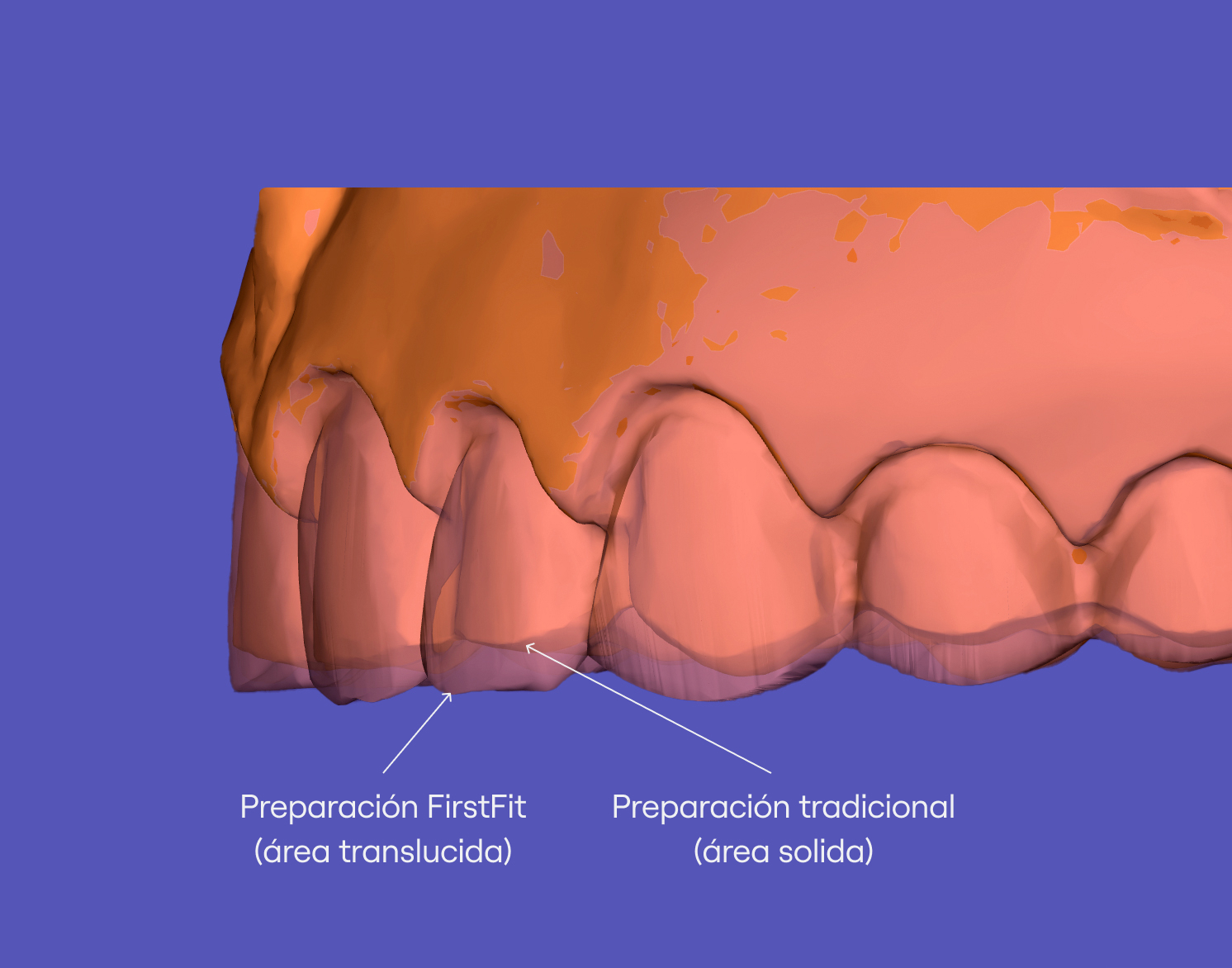 Better preps, better results