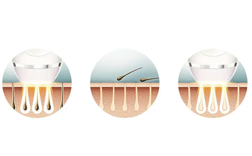 Phases IPL