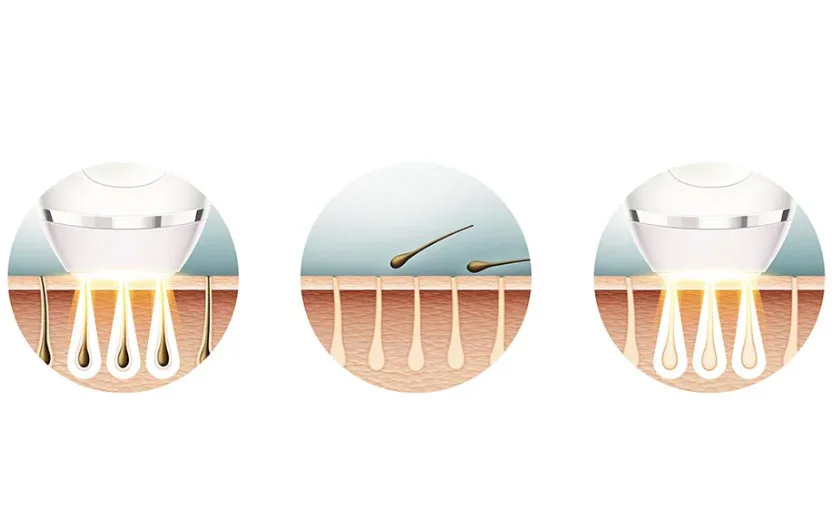 Phases IPL