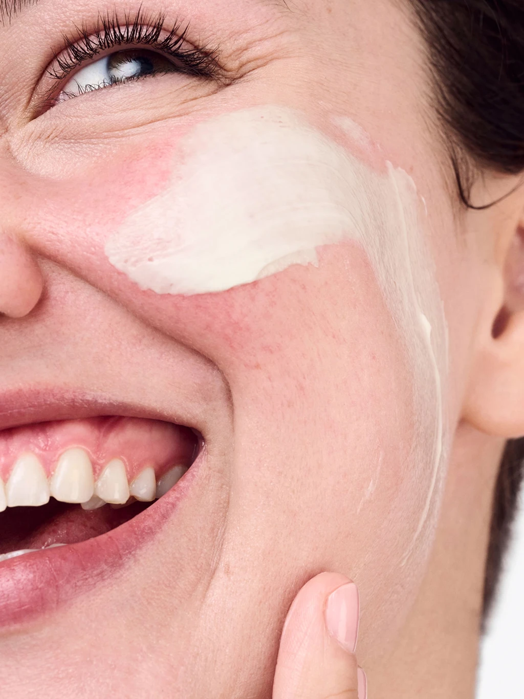 Woman applying a skin cream to the red skin on her face