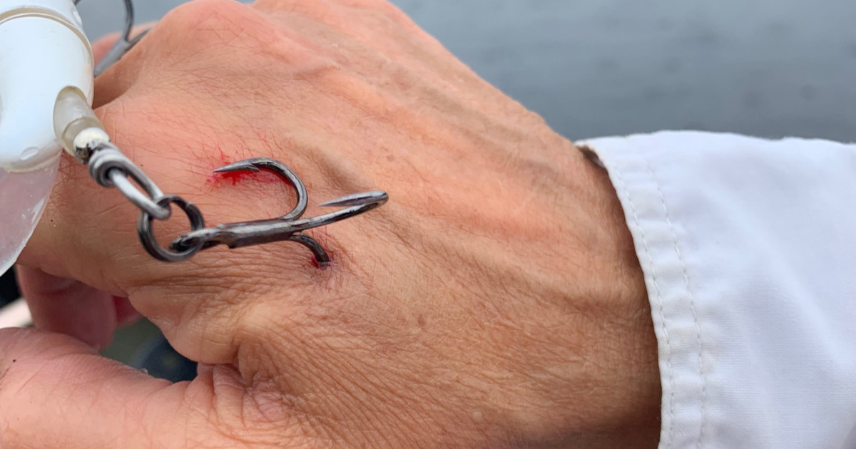 Human Catch and Release: Tales and Tips for Unhooking Anglers | MeatEater Fishing Human Catch and Release: Tales and Tips for Unhooking Anglers | MeatEater Fishing