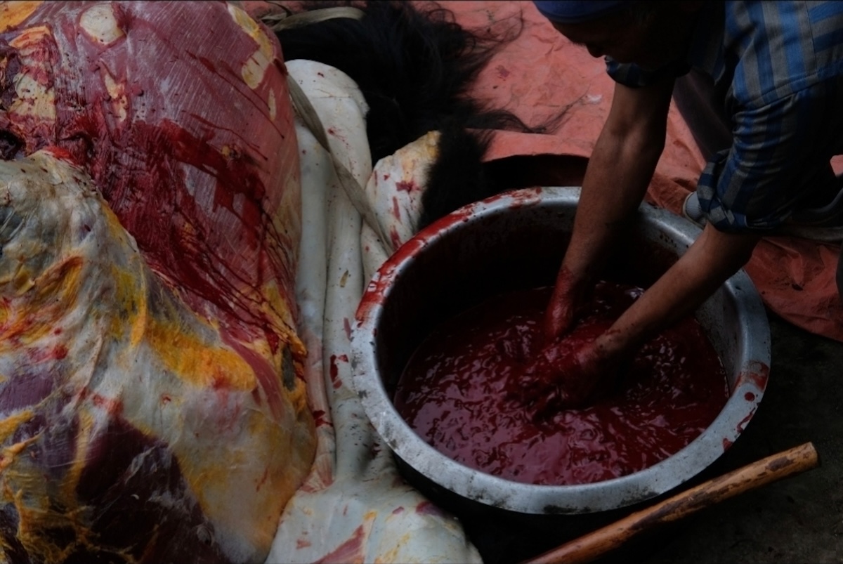  Blood photo