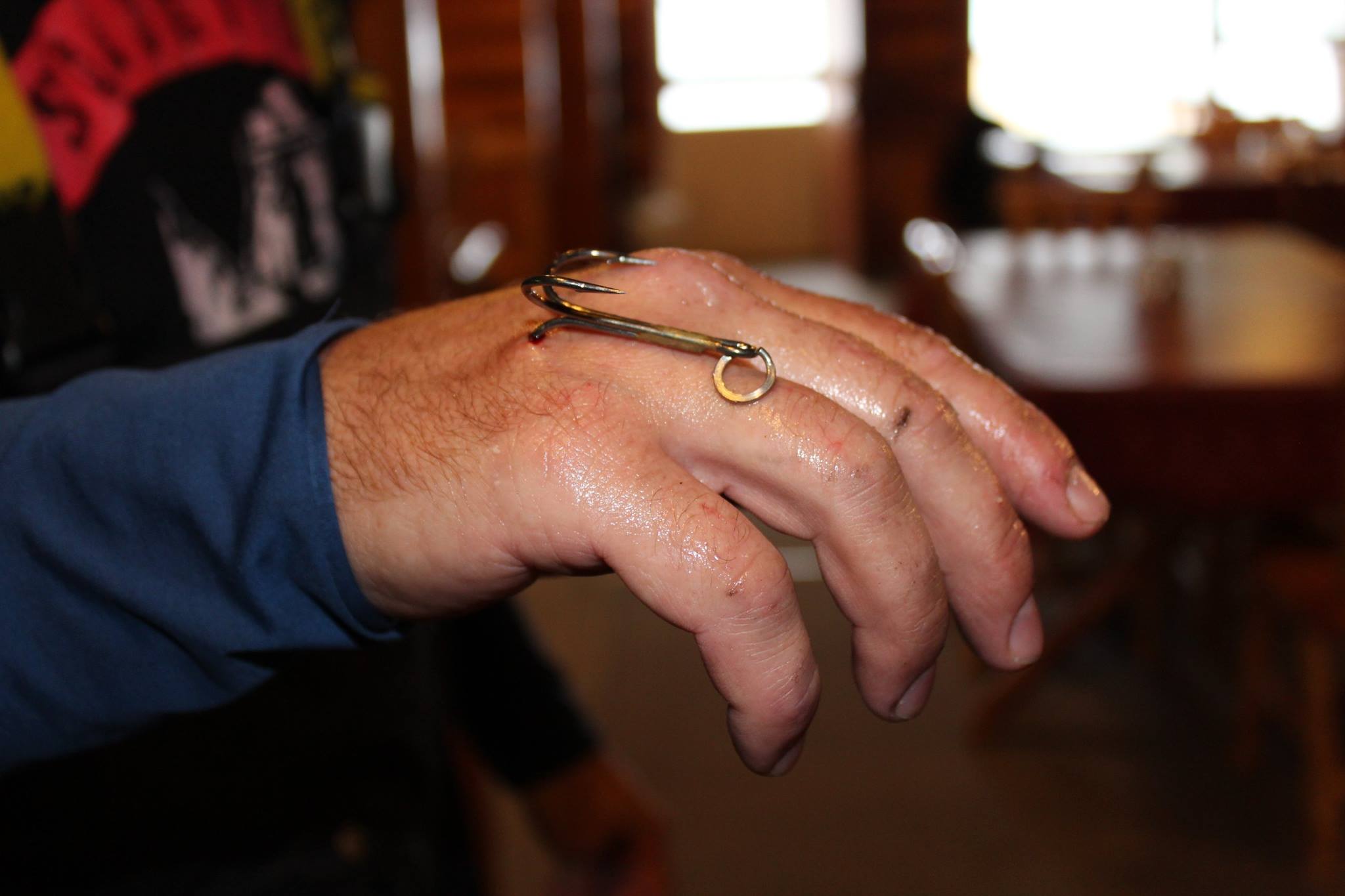 Gruesome fish hook accident - Ryan Moody Fishing