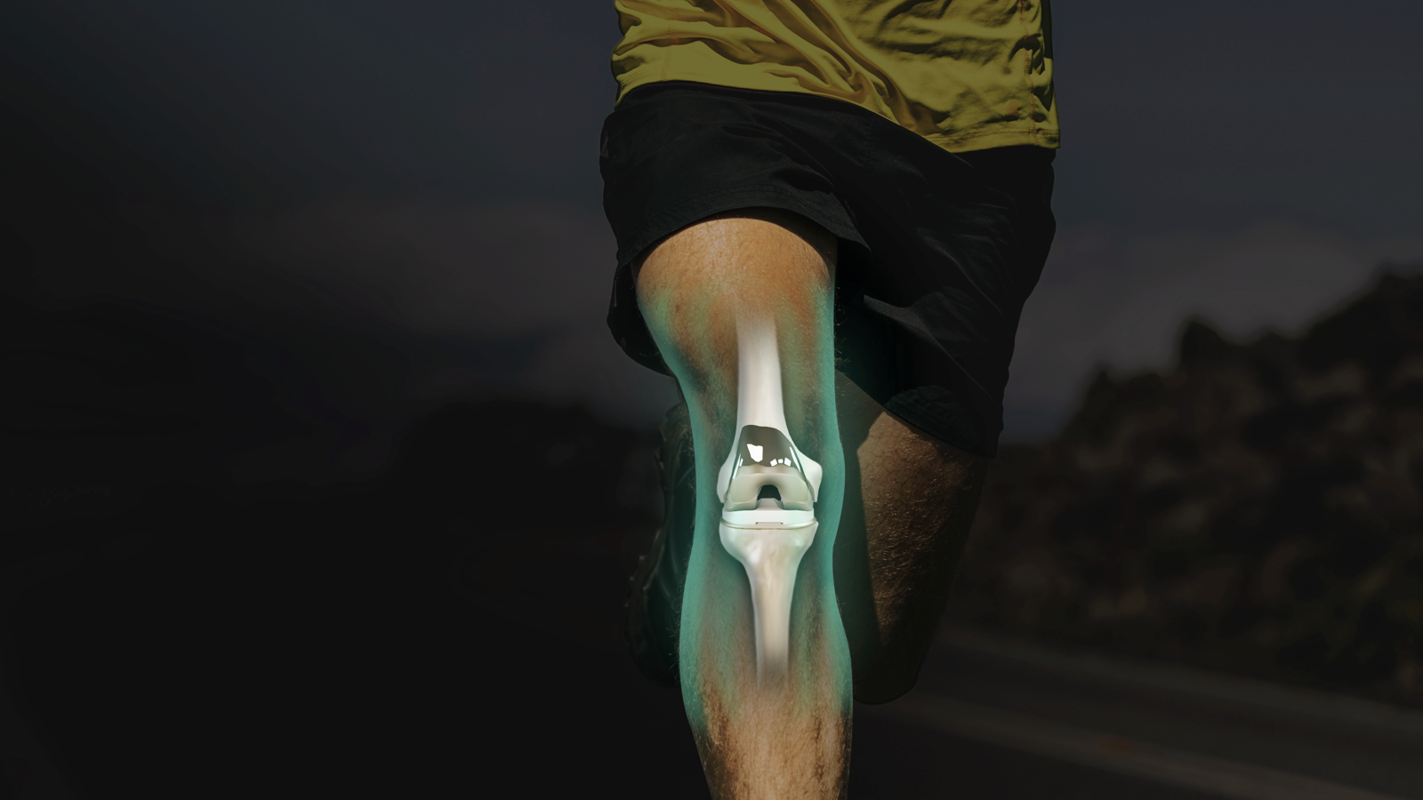 Man running with x-ray effect on leg showing knee replacement.