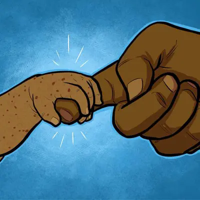 Digital cartoon by Michel Mulipola depicting a brown adult arm with a Samoan tatau holding hands with a small brown hand covered in 62 red spots representing each of the 62 children who had died in the measles epidemic in Samoa.
