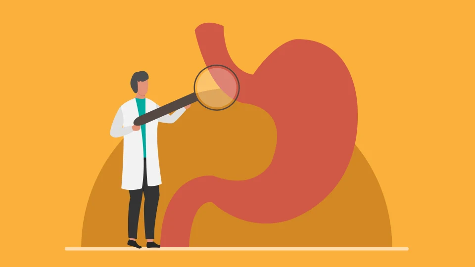 Ilustración de un médico mirando el colon