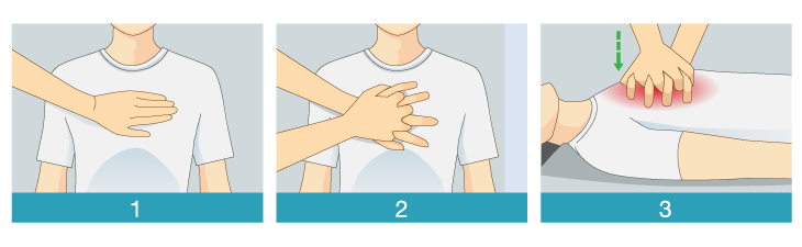 When-someone-nearby-is-having-a-heart-attack-HN2081-Body-Stock-623844810-Sized