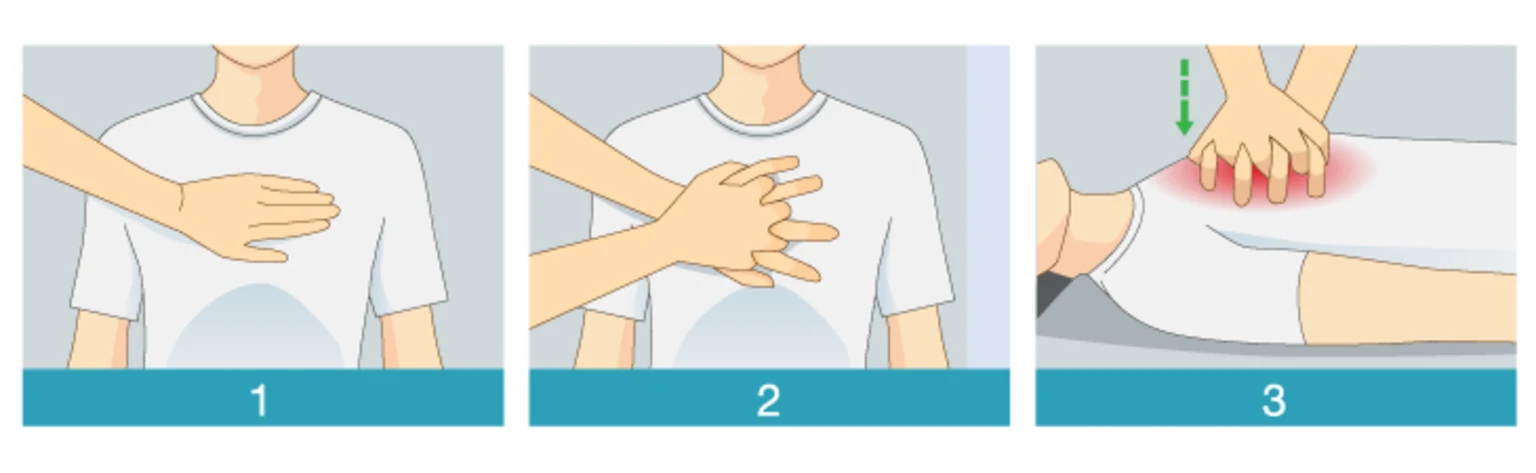 When-someone-nearby-is-having-a-heart-attack-HN2081-Body-Stock-623844810-Sized