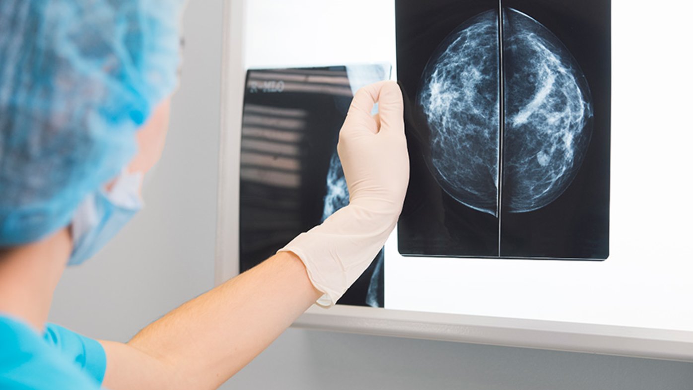 Doctor in surgery outfit holding a mammogram in front of x-ray illuminator