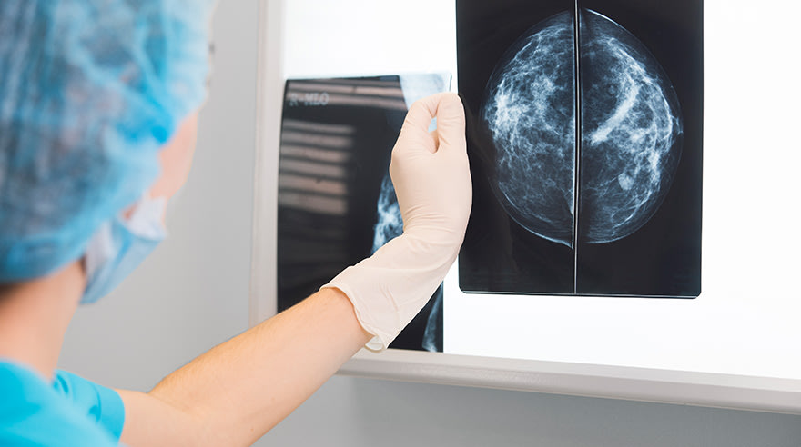 Doctor in surgery outfit holding a mammogram in front of x-ray illuminator