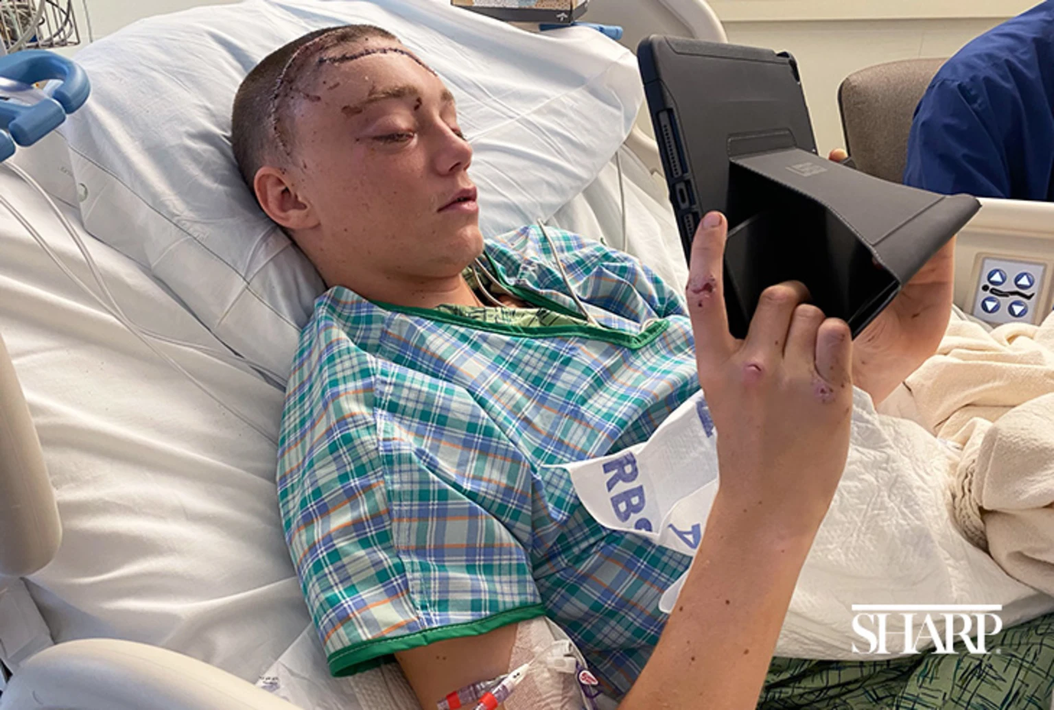 Sharp-Memorial-Teen-TBI-Patient-Recovery-HN2633-Body-1-Sized