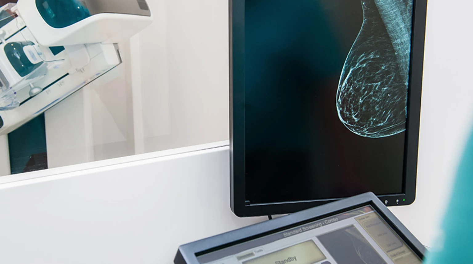 3D Mammography HN2764 iStock 903031022 Cover Sized