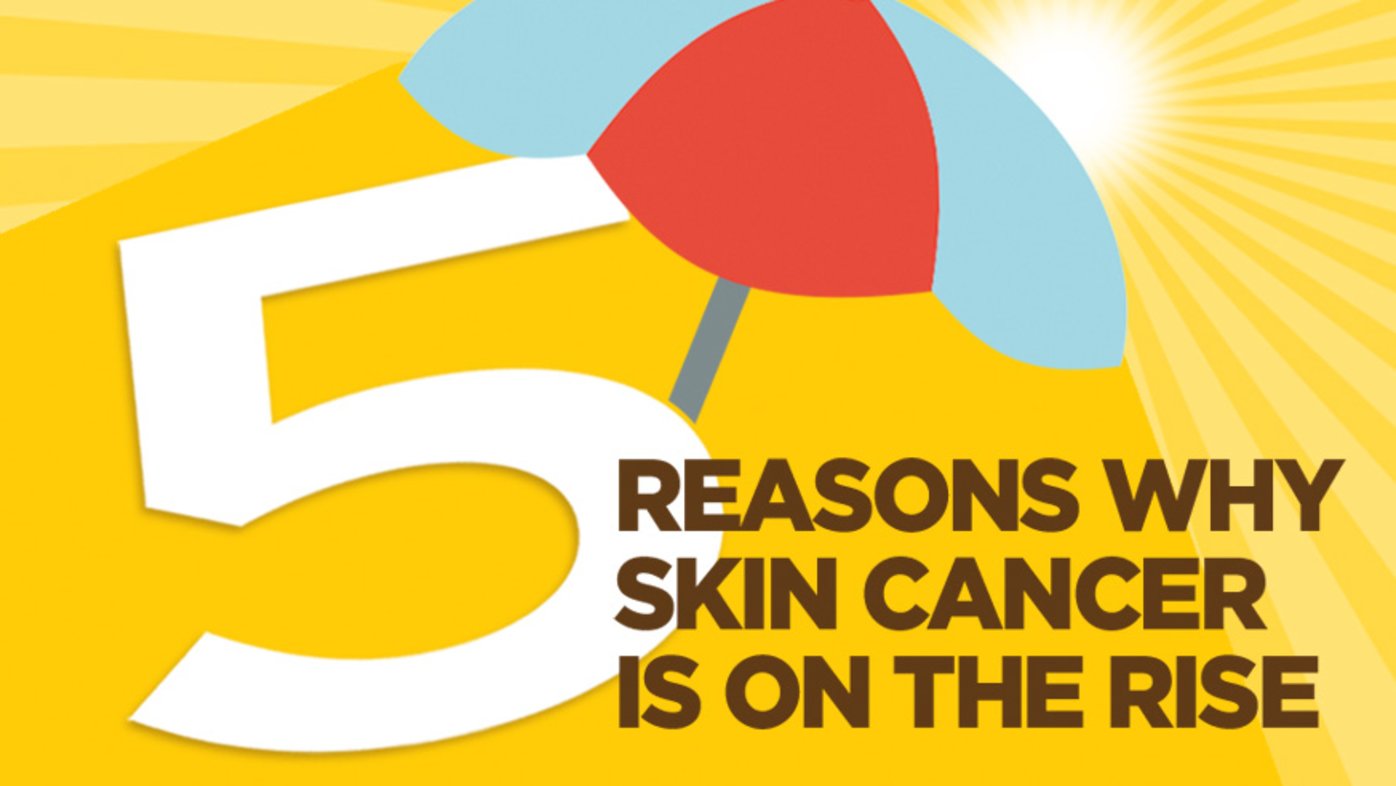 5 reasons why skin cancer is on the rise