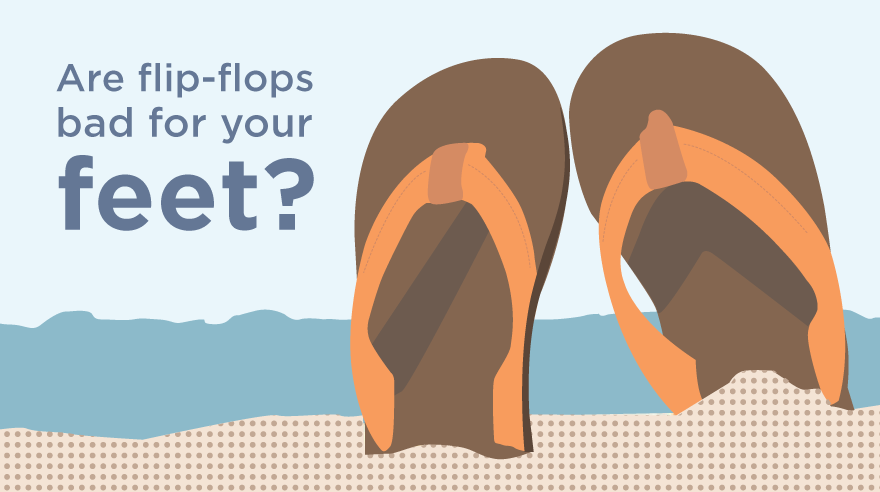 ARE FLIP-FLOPS BAD FOR YOUR FEET