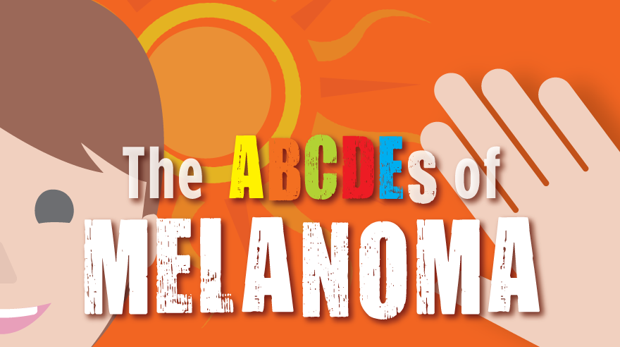 Learn the ABCDEs of melanoma (infographic) 