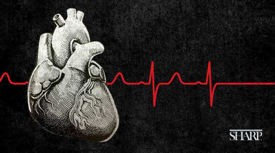 What is a ‘widowmaker’ heart attack?