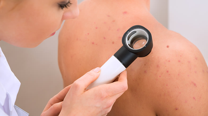Recognizing skin cancer