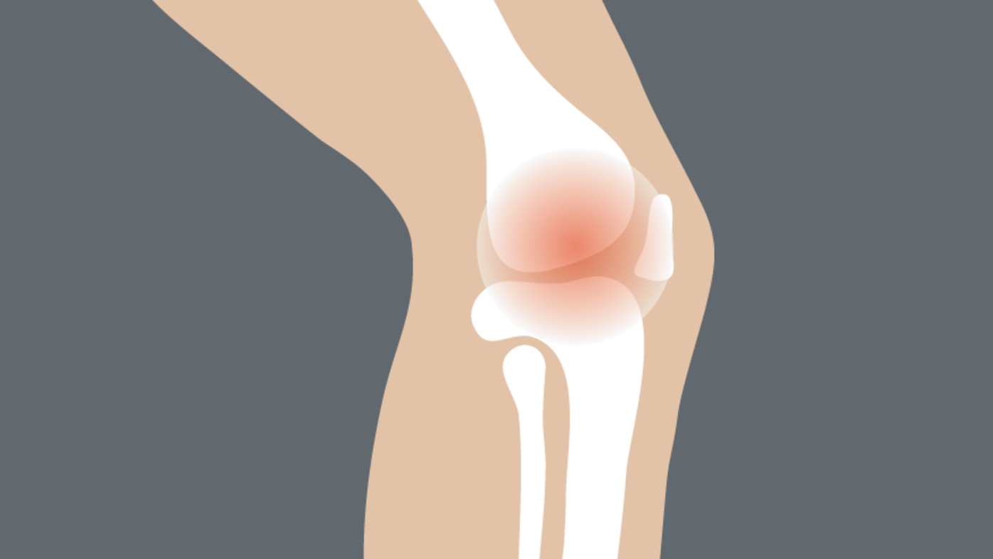 Why does my knee hurt?