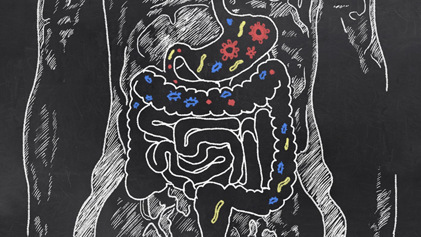 What you need to know before a colonoscopy