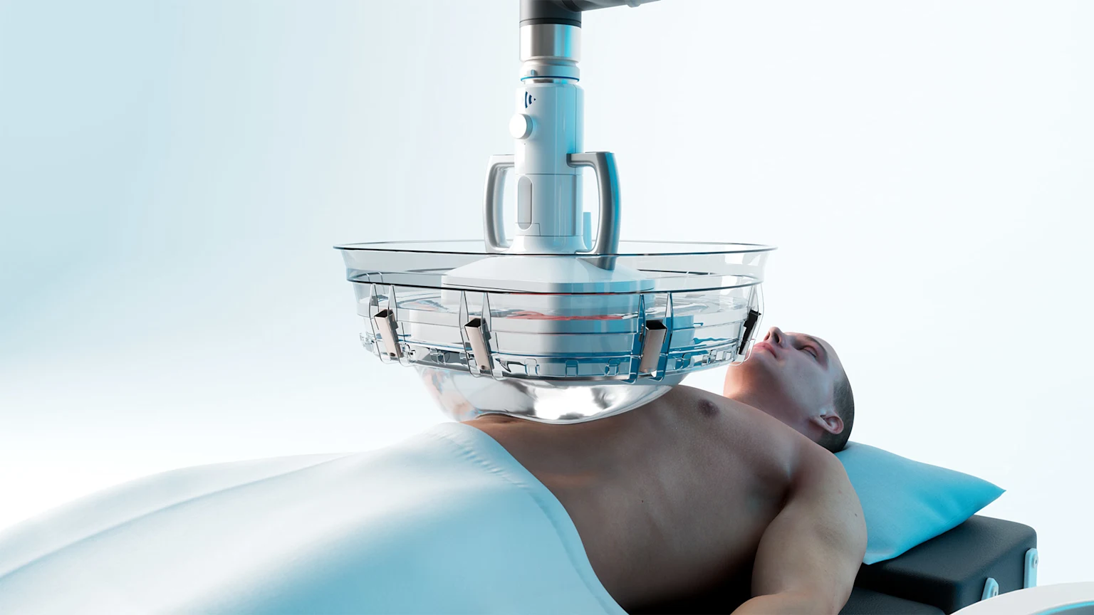 Histotripsy cancer treatment at Sharp Memorial Hospital