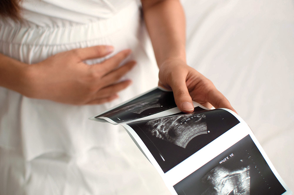 Schwanger Frau mit Ultraschallbildern