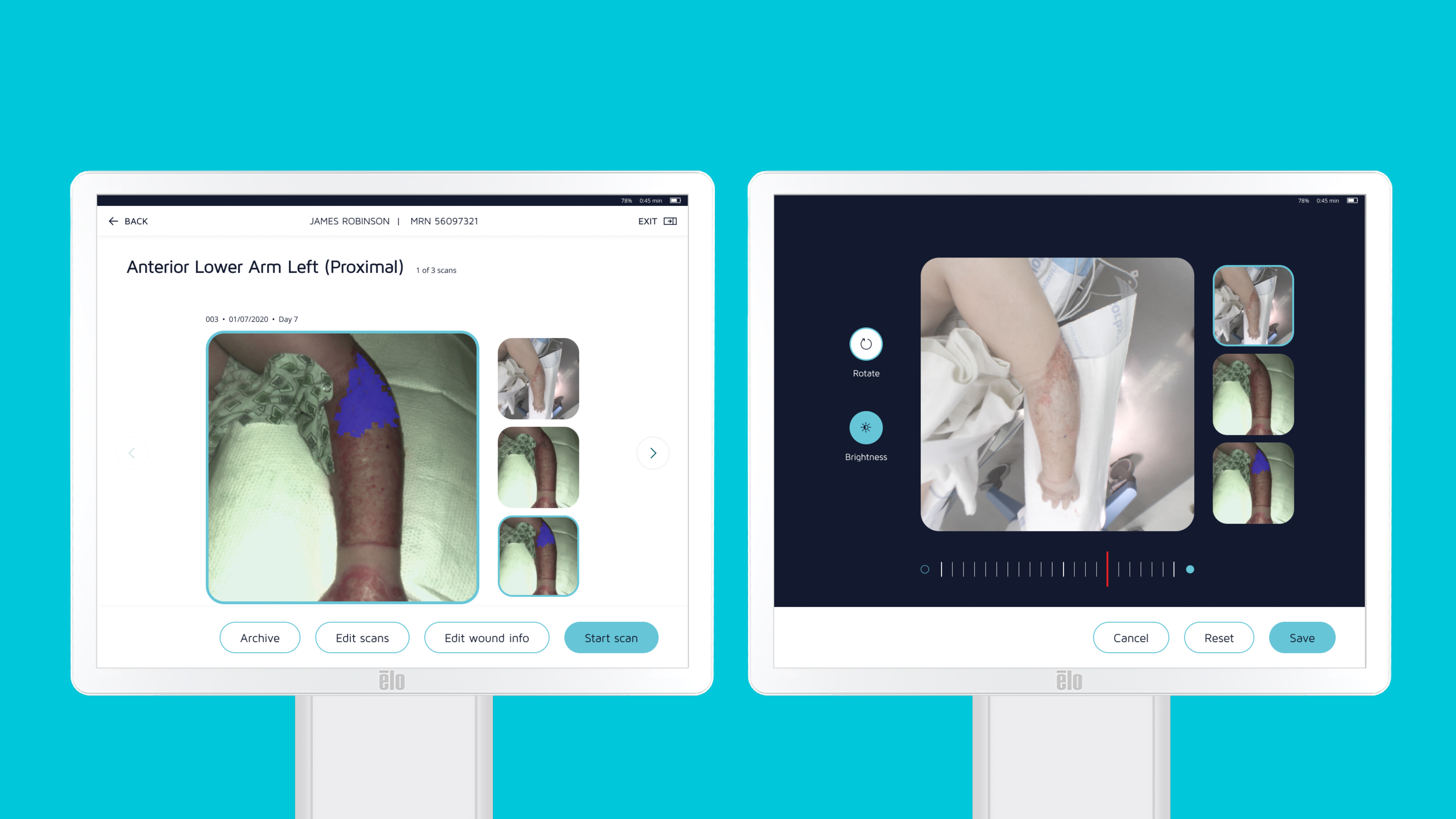 DeepView Product screens: edit wound image