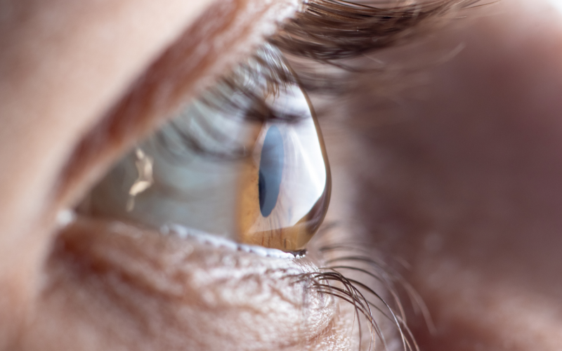 What is Astigmatism?