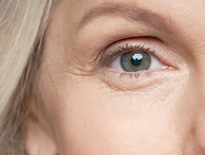 OPT-Service-Cataract-What-Are-Symptoms