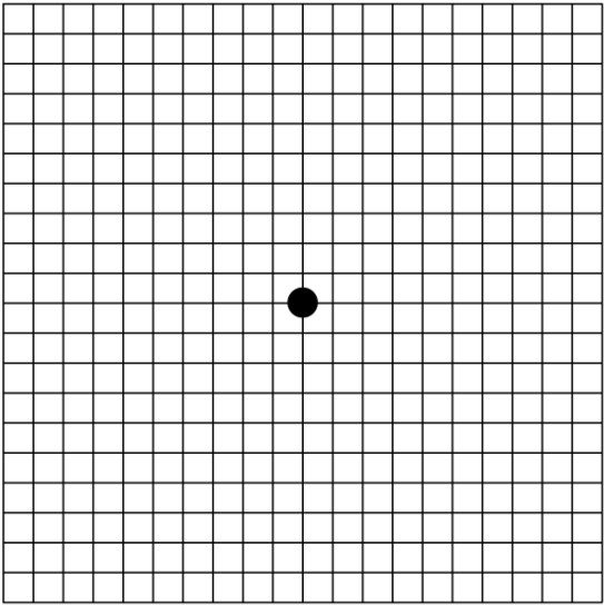 Amsler Grid