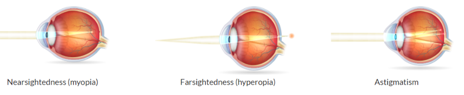 Vivid Tukel Eye Center Moment in HD Vivid Tukel Eye Center Moment in HD