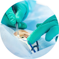 OPT-Service-Cataract-DayOf-circle3