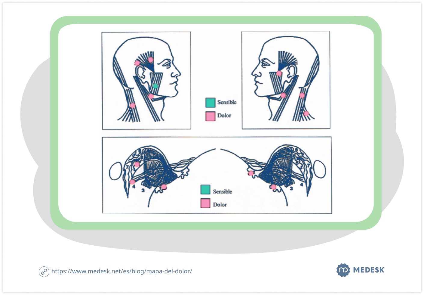 mapa-del-dolor-body-chart-2