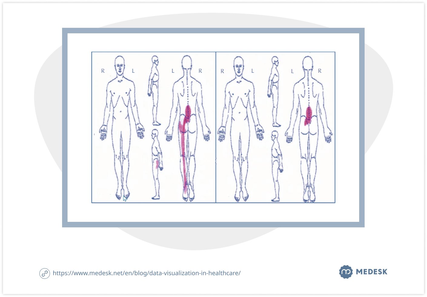 data-visualization-in-healthcare-inf1