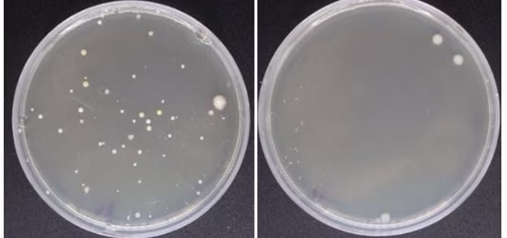 Bacteria from car keys