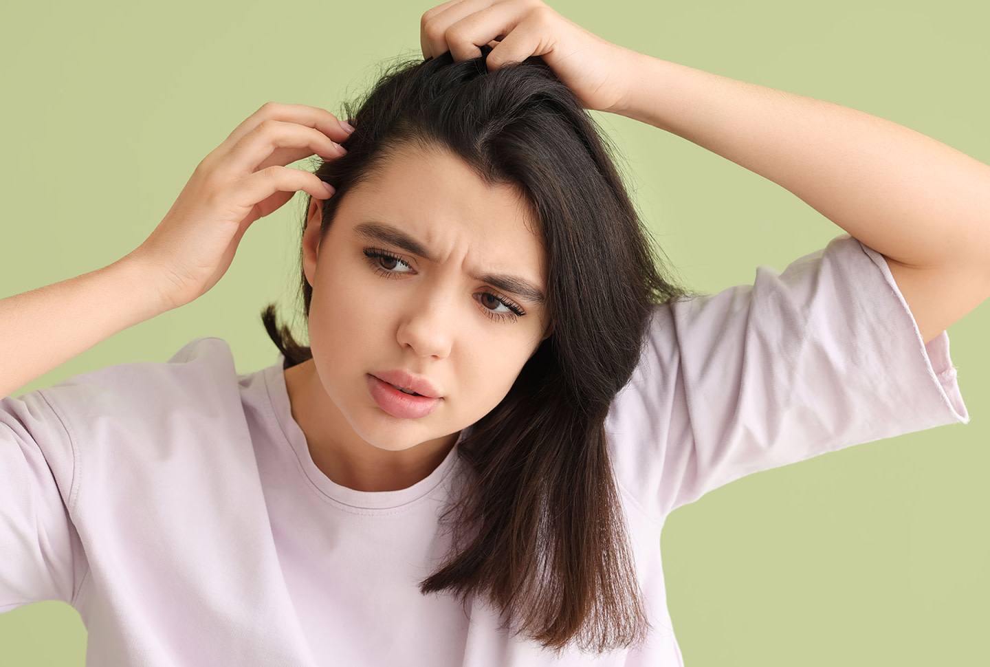 Mujer joven con picazón en el cuero cabelludo y problema de caspa escamosa examinando su cabello sobre fondo verde Mujer joven con picazón en el cuero cabelludo y problema de caspa escamosa examinando su cabello sobre fondo verde