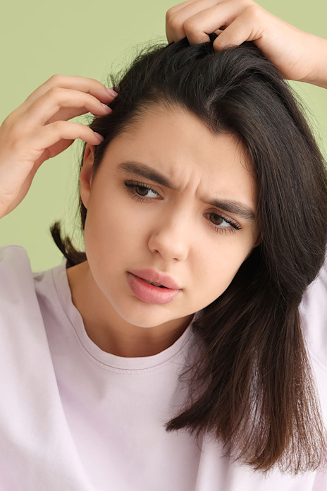 ¿Por qué mi cuero cabelludo tiene tanta picazón y escamas?-image ¿Por qué mi cuero cabelludo tiene tanta picazón y escamas?-image