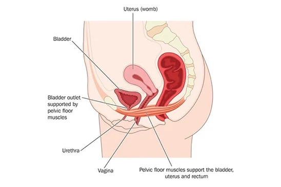 Illustration of urge incontinence