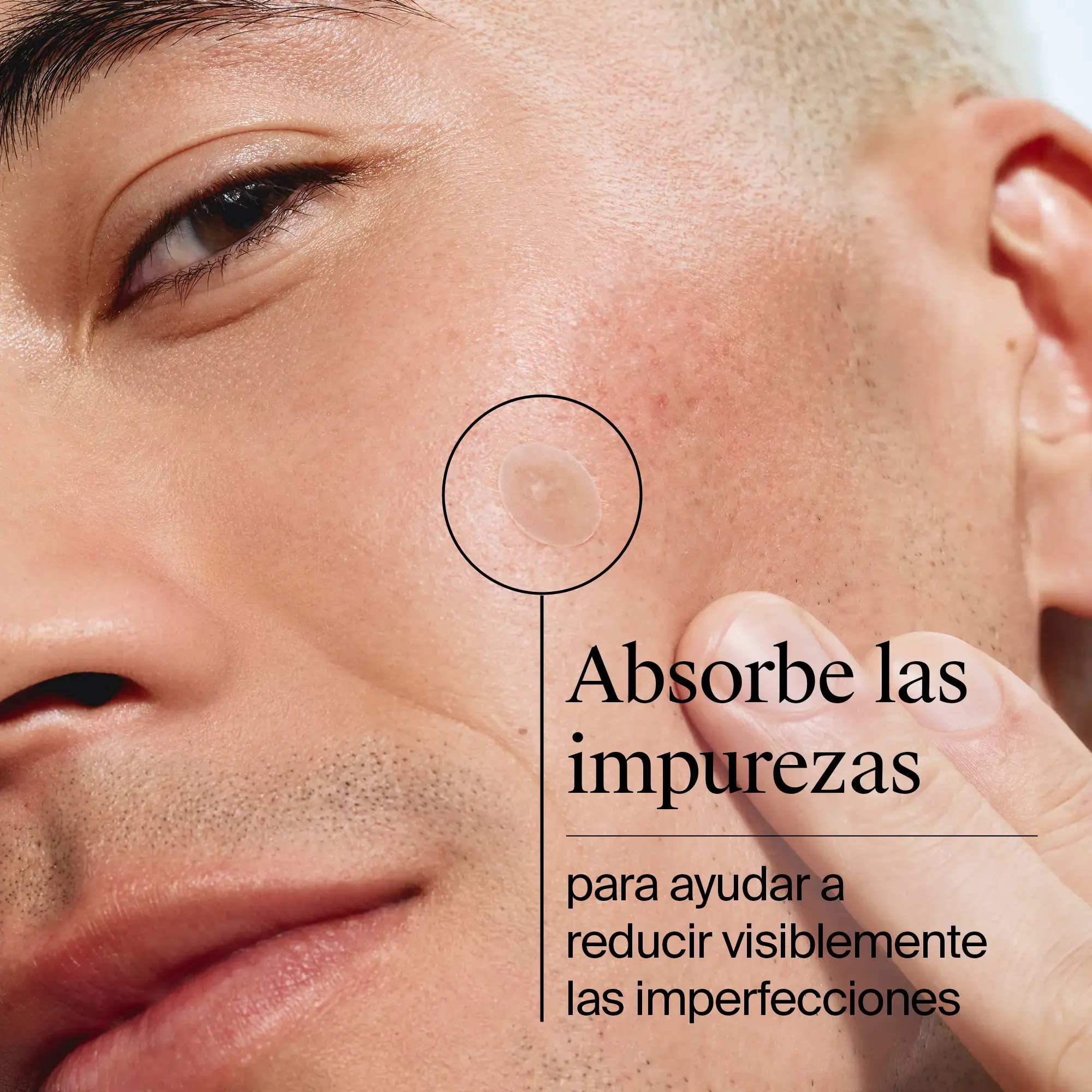 Clear & Defend+ Parches para Imperfecciones Piel Sensible
